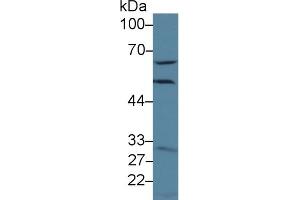 Detection of GCLM in Human Hela cell lysate using Polyclonal Antibody to Glutamate Cysteine Ligase, Modifier Subunit (GCLM) (GCLM antibody  (AA 40-251))