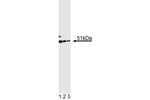 Western blot analysis of HNF-1beta on a rat kidney lysate. (HNF1B antibody  (AA 1-101))