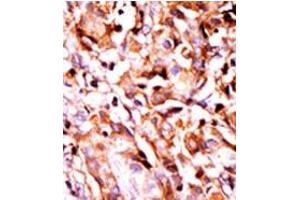 Image no. 1 for anti-BCL2-Associated Agonist of Cell Death (BAD) (pSer99) antibody (ABIN358087) (BAD antibody  (pSer99))