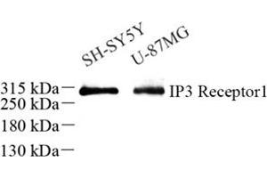 Western blot analysis of IP3R1 (ABIN7074293) at dilution of 1: 500 (IP3 Receptor antibody)
