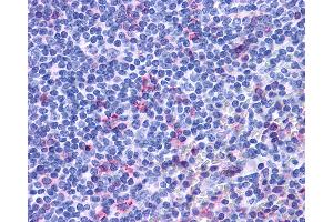 Anti-ACKR3 / CXCR7 / RDC1 antibody IHC of human tonsil. (CXCR7 antibody  (Extracellular Domain))
