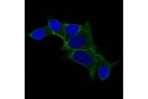 Image no. 1 for anti-Ornithine Decarboxylase 1 (ODC1) antibody (ABIN6188965) (ODC1 antibody)