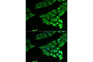 Immunofluorescence analysis of U2OS cells using PSAT1 antibody (ABIN5974050). (PSAT1 antibody)