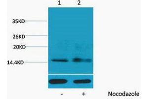 Western Blotting (WB) image for anti-Histone H1 (pSer1) antibody (ABIN3181348) (Histone H1 antibody  (pSer1))