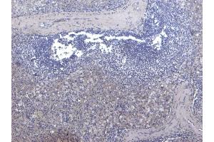 (ABIN185707) Negative Control showing staining of paraffin embedded Human Spleen, with no primary antibody. (Septin 1 antibody  (Internal Region))