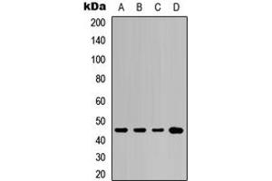 Western blot analysis of Cytokeratin 20 expression in A549 (A), NS-1 (B), mouse kidney (C), rat kidney (D) whole cell lysates. (KRT20 antibody  (C-Term))