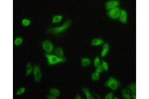 Detection of TNFR1 in Hela cells using Polyclonal Antibody to Tumor Necrosis Factor Receptor 1 (TNFR1) (TNFRSF1A antibody  (AA 60-236))