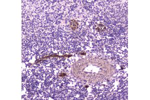 Immunohistochemistry (IHC) image for anti-CD163 (CD163) (AA 47-201) antibody (ABIN5693082)