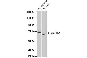 Western blot analysis of extracts of various cell lines, using Gm13125 antibody. (Pramel15 antibody)