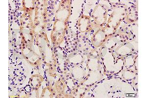 Formalin-fixed and paraffin embedded rat kidney tissue labeled with Anti-Smad7/Smad6 Polyclonal Antibody (ABIN670206), Unconjugated at 1:200, followed by conjugation to the secondary antibody and DAB staining (SMAD7 antibody  (AA 1-100))