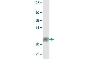 Western Blot detection against Immunogen (36. (TNRC6C antibody  (AA 1-100))