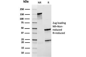 SDS-PAGE (SDS) image for anti-Complement Component (3d/Epstein Barr Virus) Receptor 2 (CR2) (AA 44-196) antibody (ABIN6939181)