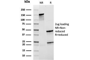 SDS-PAGE Analysis Purified CD21 Recombinant Mouse Monoclonal Antibody (rCR2/1952). (Recombinant CD21 antibody  (AA 44-196))