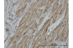 Image no. 1 for anti-Pyruvate Dehydrogenase beta (PDHB) (AA 250-360) antibody (ABIN598861) (PDHB antibody  (AA 250-360))