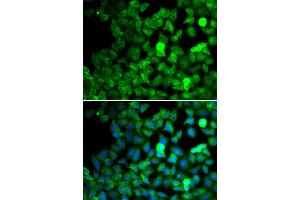 Immunofluorescence analysis of MCF7 cell using SARS antibody. (Seryl-tRNA Synthetase (SARS) antibody)