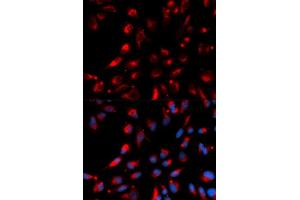Immunofluorescence (IF) image for anti-Carboxypeptidase E (CPE) antibody (ABIN1876646) (CPE antibody)