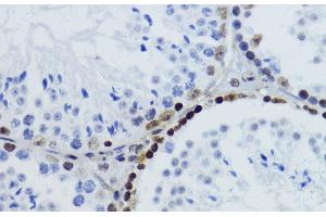 Immunohistochemistry (Paraffin-embedded Sections) (IHC (p)) image for anti-Histone H2B (acLys12) antibody (ABIN7258518)