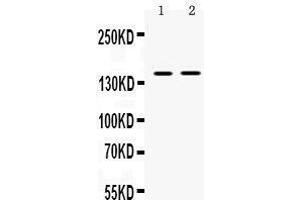 Observed bind size: 150KD (TRIM33 antibody  (AA 1001-1127))