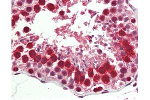 Human, Testis: Formalin-Fixed Paraffin-Embedded (FFPE) (C22orf28 antibody  (AA 201-214))