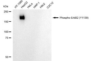 Western blotting analysis using Phospho-ErbB2 (Y) antibody (ABIN7800159).