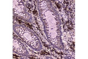 IHC analysis of IGF2R using anti-IGF2R antibody . (IGF2R antibody  (AA 424-529))
