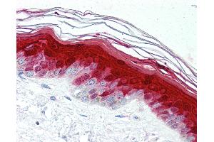 Anti-S100A7 antibody IHC of human skin. (S100A7 antibody)