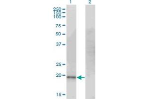 Western Blot analysis of CDO1 expression in transfected 293T cell line by CDO1 monoclonal antibody (M09), clone 4B4. (CDO1 antibody  (AA 101-200))