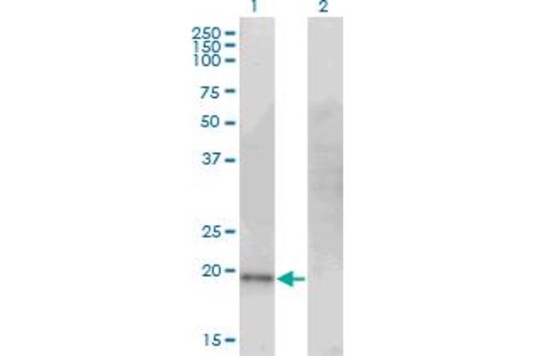 CDO1 antibody  (AA 101-200)