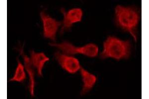 ABIN6266926 staining A549 by IF/ICC. (CERKL antibody  (Internal Region))