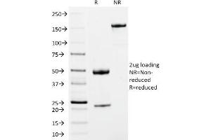 SDS-PAGE Analysis Purified IgM Mouse Monoclonal Antibody (IM373). (IGHM antibody  (CF®488A))