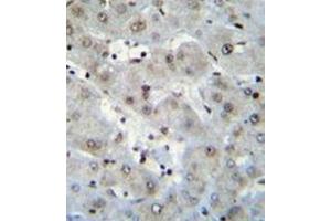 Immunohistochemistry (Paraffin-embedded Sections) (IHC (p)) image for anti-H2A Histone Family, Member Z (H2AFZ) (AA 66-94), (C-Term) antibody (ABIN952744)