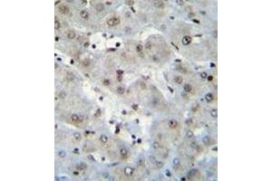 Immunohistochemistry analysis in formalin fixed and paraffin embedded human liver tissue reacted with H2AFZ Antibody (C-term) followed by peroxidase conjugation of the secondary antibody and DAB staining. (H2AFZ antibody  (C-Term))