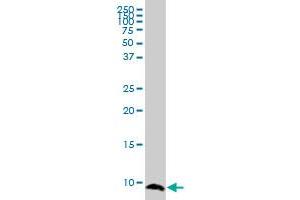 ATOX1 monoclonal antibody (M04), clone 3G11. (ATOX1 antibody  (AA 1-68))