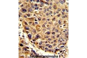 Immunohistochemistry (IHC) image for anti-Signal Peptidase Complex Subunit 3 Homolog (SPCS3) antibody (ABIN3002742) (SPCS3 antibody)