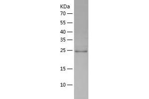 DTYMK Protein (AA 1-212) (His tag)