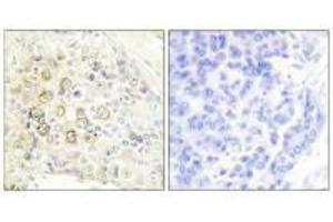 Immunohistochemistry (IHC) image for anti-Receptor Tyrosine-Protein Kinase ErbB-3 (ERBB3) (N-Term) antibody (ABIN7184459)