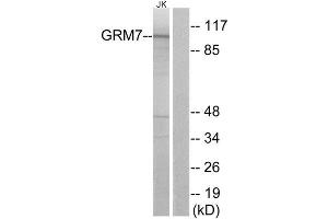 Western Blotting (WB) image for anti-Glutamate Receptor, Metabotropic 7 (GRM7) (Internal Region) antibody (ABIN1853052) (GRM7 antibody  (Internal Region))