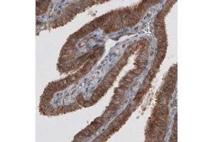 Immunohistochemical staining (Formalin-fixed paraffin-embedded sections) of human fallopian tube with VPS26A monoclonal antibody, clone CL2287  shows strong granular cytoplasmic immunoreactivity in glandular epithelium cells. (VPS26A antibody)