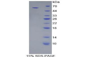 SDS-PAGE analysis of Pig Cadherin, Epithelial Protein. (E-cadherin Protein)
