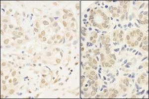 Immunohistochemistry (IHC) image for anti-V-Myb Myeloblastosis Viral Oncogene Homolog (Avian) (MYB) (AA 225-275) antibody (ABIN7454503)