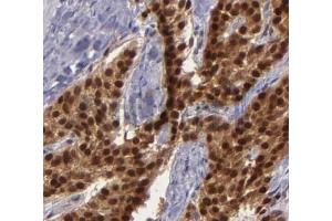 ABIN6268682 at 1/100 staining human breast tissues sections by IHC-P.