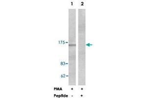 Western blot analysis of extracts from HeLa cells treated with PMA (125 ng/ml, 30 min), using PLCB3 polyclonal antibody . (PLCB3 antibody  (Ser1105))