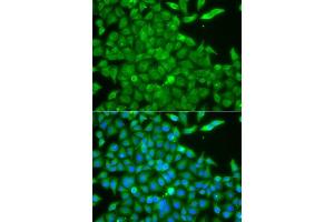 Immunofluorescence analysis of A549 cells using CSNK1G2 antibody. (Casein Kinase 1 gamma 2 antibody  (AA 316-415))