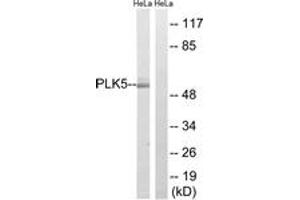 Western blot analysis of extracts from HeLa cells, using PLK5 Antibody. (PLK5 antibody  (AA 131-180))