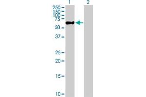 Western Blot analysis of ZNF671 expression in transfected 293T cell line by ZNF671 MaxPab polyclonal antibody. (ZNF671 antibody  (AA 1-556))