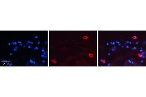 MAP2K2 antibody - C-terminal region          Formalin Fixed Paraffin Embedded Tissue:  Human Lung Tissue    Observed Staining:  Cytoplasm of pneumocytes   Primary Antibody Concentration:  1:600    Secondary Antibody:  Donkey anti-Rabbit-Cy3    Secondary Antibody Concentration:  1:200    Magnification:  20X    Exposure Time:  0. (MEK2 antibody  (C-Term))