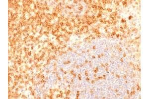 Formalin-fixed, paraffin-embedded human Tonsil stained with CD27 Recombinant Mouse Monoclonal Antibody (rLPFS2/1611). (Recombinant CD27 antibody)