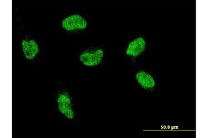 Immunofluorescence of monoclonal antibody to HOXA5 on HeLa cell. (HOXA5 antibody  (AA 171-270))