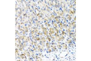 Immunohistochemistry of paraffin-embedded mouse stomach using RAD51C antibody (ABIN5974185) at dilution of 1/100 (40x lens).