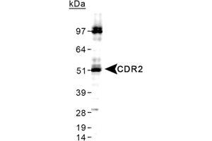 Western blot analysis of CDR2 in HeLa whole cell lysate using CDR2 polyclonal antibody . (CDR2 antibody  (C-Term))